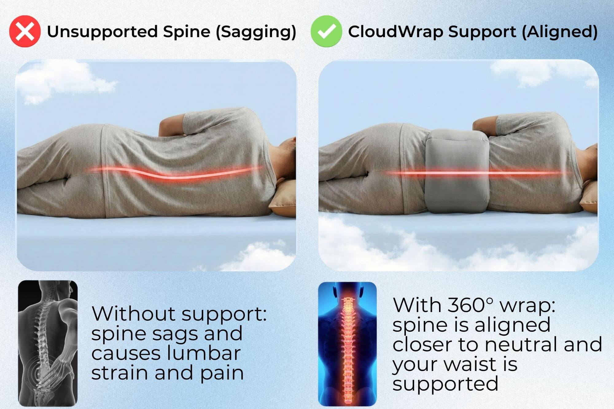 Comparison image showing an unsupported sagging spine versus a neutral, aligned spine when wearing the CloudWrap sleep lumbar support pillow, highlighting reduced lumbar strain during sleep.