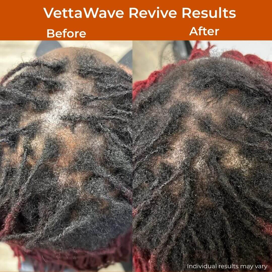 VettaWave Revive 7-in-1 Neon High Frequency Wand - Glow System