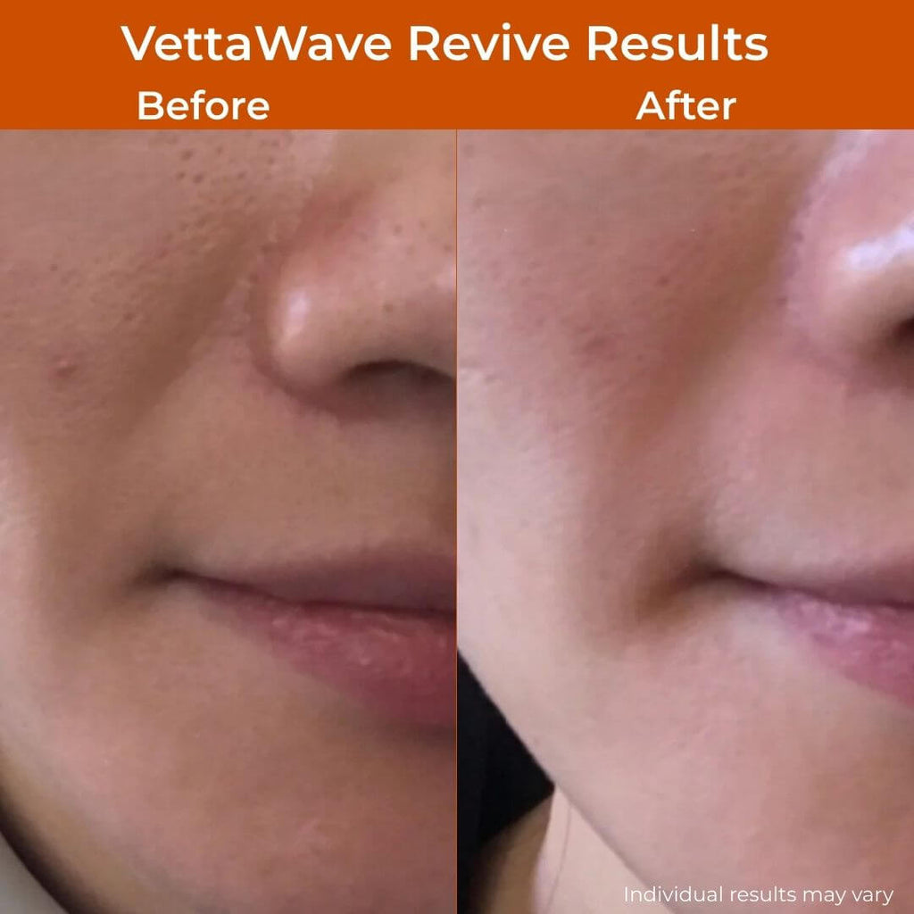 VettaWave Revive 7-in-1 Neon High Frequency Wand - Glow System