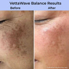 VettaWave Balance High Frequency Wand (7 Tubes) - Restoration System