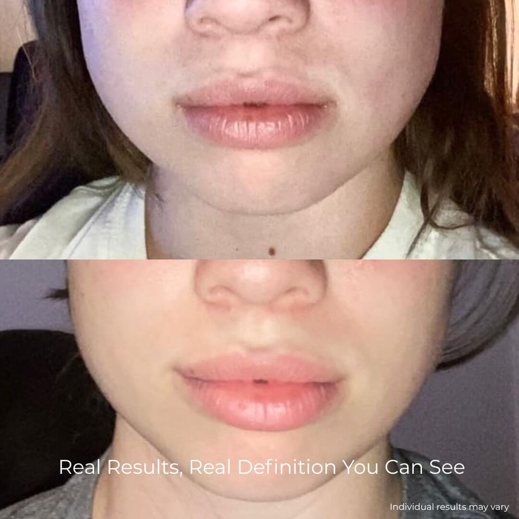 V-Sculpt EMS & LED System for Jawline Definition & Body Tension Relief