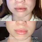 V-Sculpt EMS & LED System for Jawline Definition & Body Tension Relief