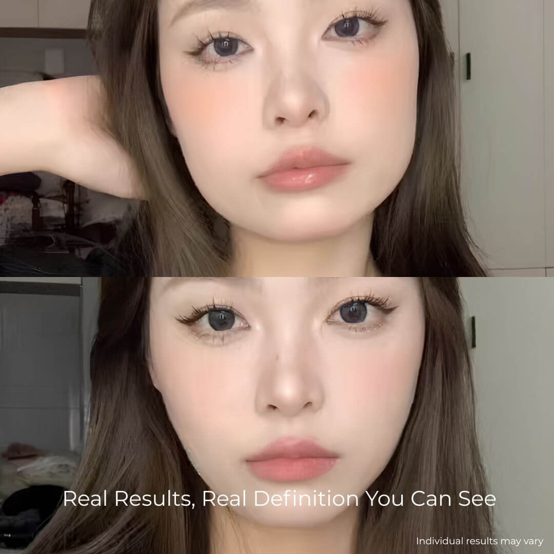 V-Sculpt EMS & LED System for Jawline Definition & Body Tension Relief